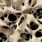 New Breakthrough to Strengthen Bones Could