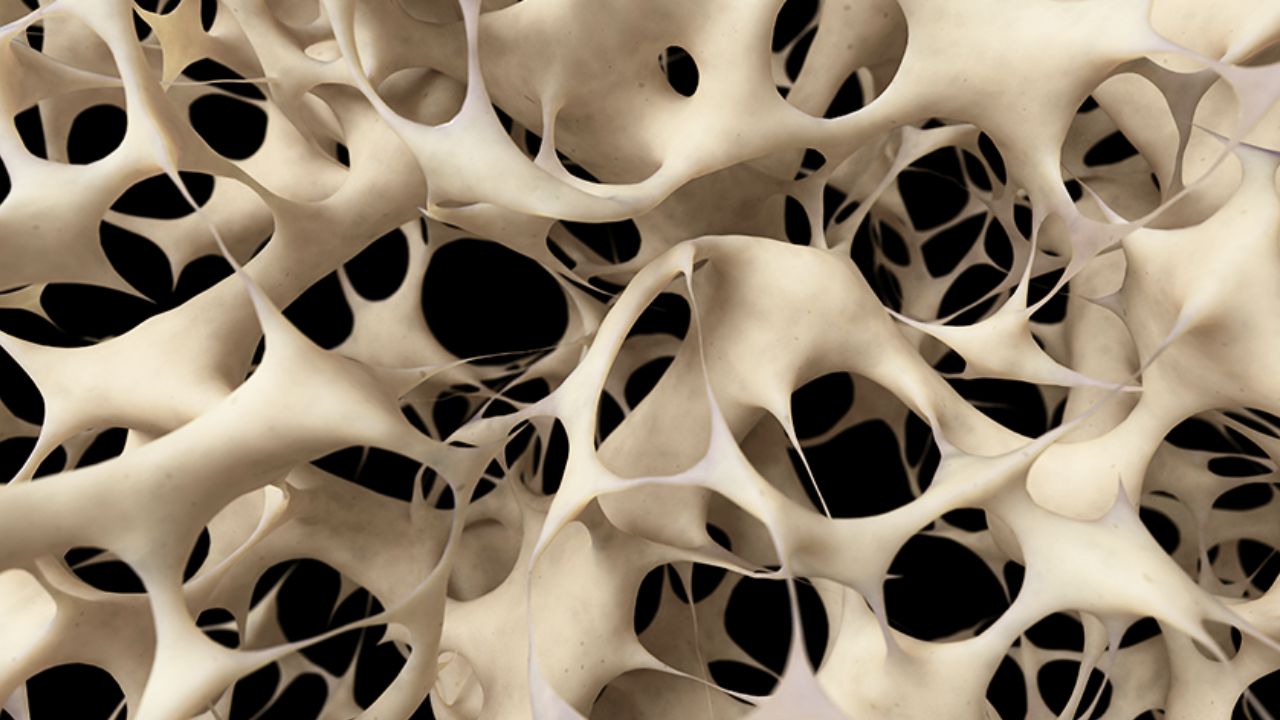 New Breakthrough to Strengthen Bones Could Reverse Osteoporosis